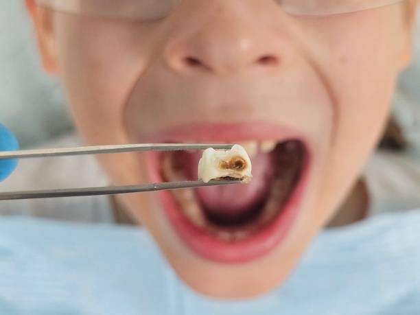 Best Pediatric Emergency Dentist in Bishop, CA